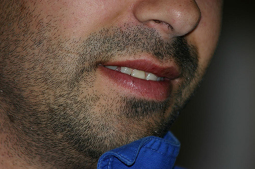 An example of thick facial hair.