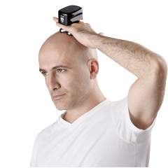 Electric head shavers have a few very compelling advantages over razor blades.